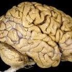 Brain